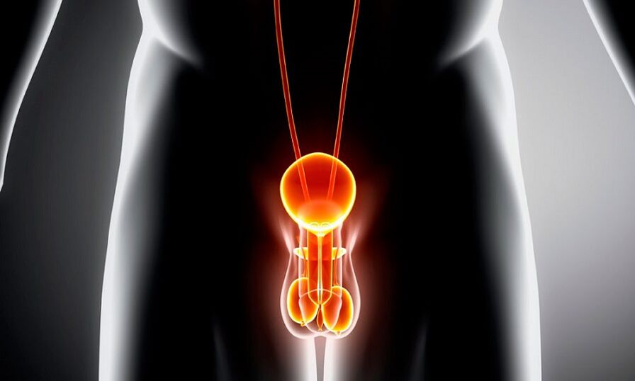 Entzündetes Geniturinus für Prostatitis