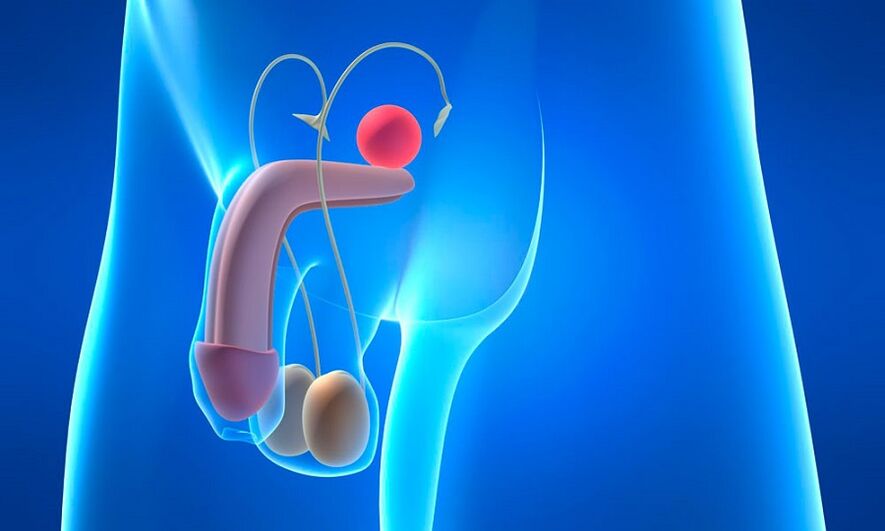 Ödeme der Prostata mit Prostatitis